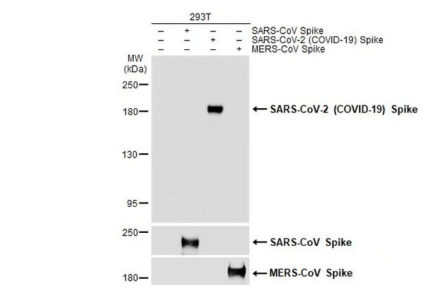 SARS-CoV-2 Spike Protein S1 Antibody in Western Blot (WB)