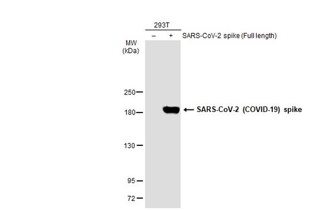 SARS-CoV-2 Spike Protein S1 Antibody in Western Blot (WB)