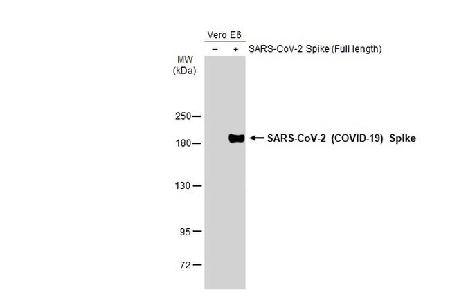 SARS-CoV-2 Spike Protein (RBD) Antibody in Western Blot (WB)