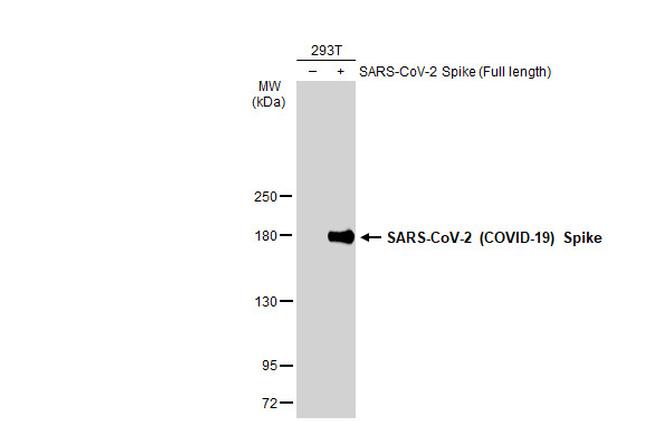 SARS-CoV-2 Spike Protein (RBD) Antibody in Western Blot (WB)