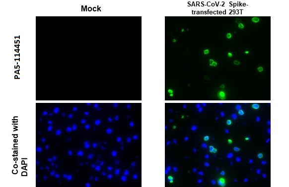 SARS-CoV-2 Spike Protein (RBD) Antibody in Immunocytochemistry (ICC/IF)