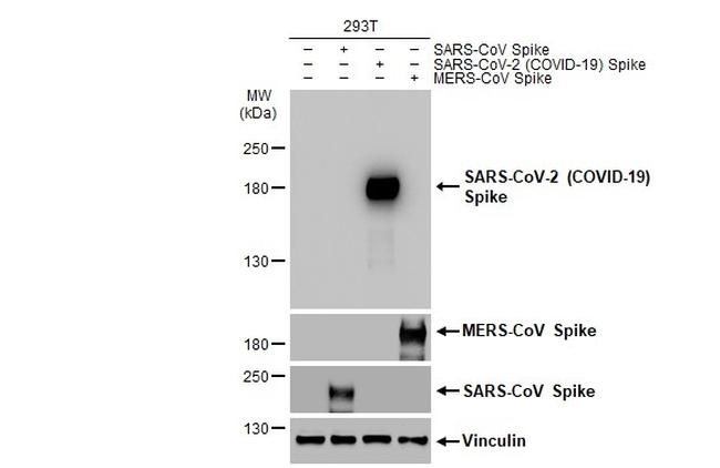 SARS-CoV-2 Spike Protein (RBD) Antibody in Western Blot (WB)