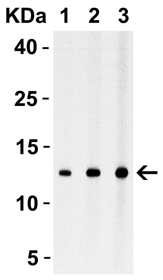 Strep Tag Antibody in Western Blot (WB)