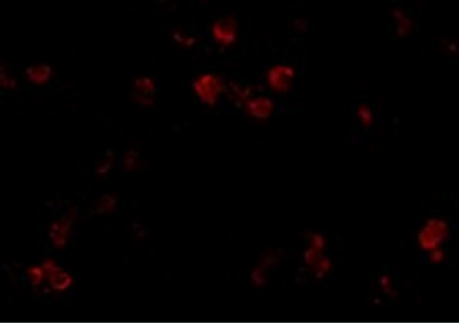 CD81 Antibody in Immunocytochemistry (ICC/IF)