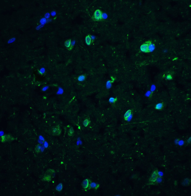 CD81 Antibody in Immunohistochemistry (Paraffin) (IHC (P))