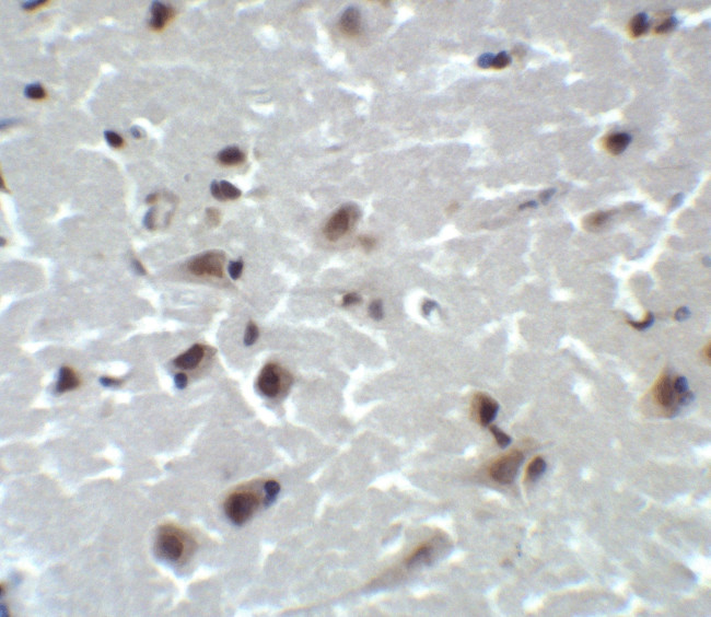 CD81 Antibody in Immunohistochemistry (Paraffin) (IHC (P))