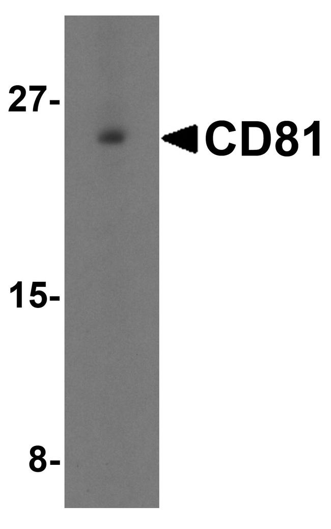 CD81 Antibody in Western Blot (WB)