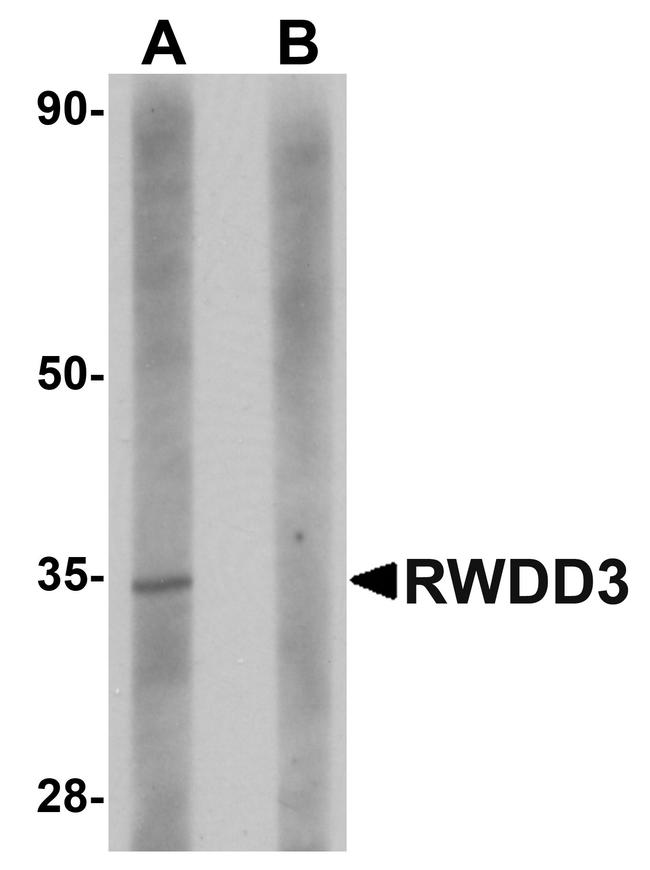 C11orf79 Antibody in Western Blot (WB)