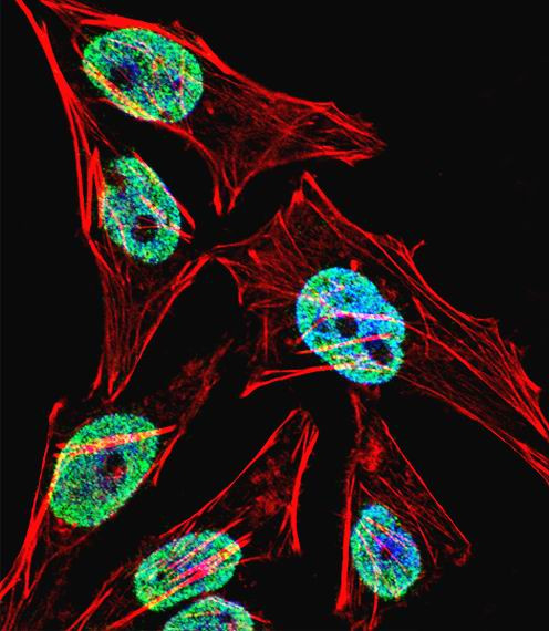 TERT Antibody in Immunocytochemistry (ICC/IF)