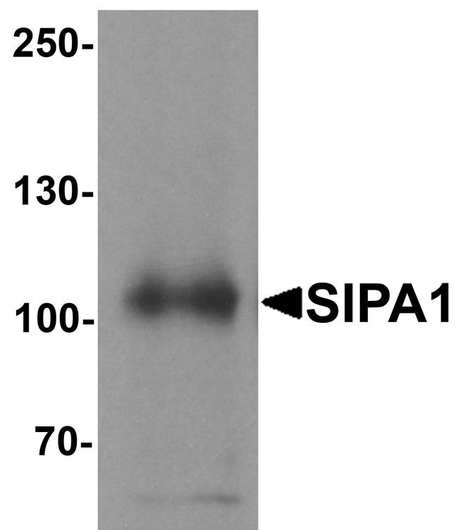 SIPA1 Antibody in Western Blot (WB)