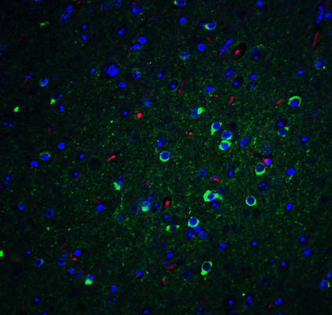 APOE Antibody in Immunohistochemistry (Paraffin) (IHC (P))