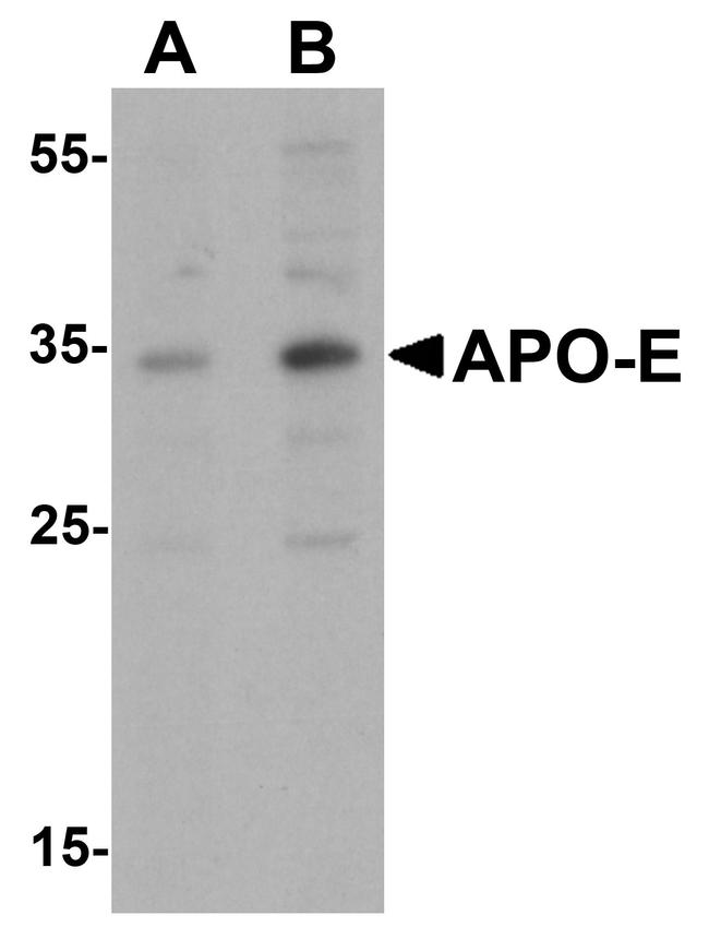 APOE Antibody in Western Blot (WB)