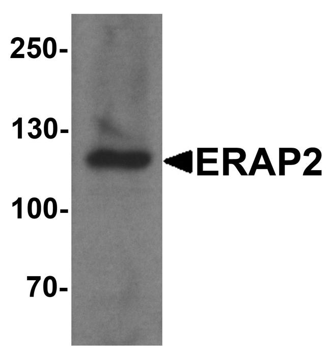 ERAP2 Antibody in Western Blot (WB)