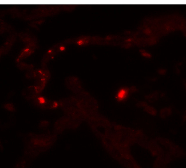 MMP9 Antibody in Immunohistochemistry (Paraffin) (IHC (P))