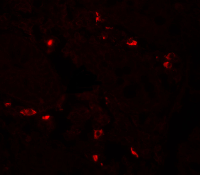 CD272 (BTLA) Antibody in Immunohistochemistry (Paraffin) (IHC (P))