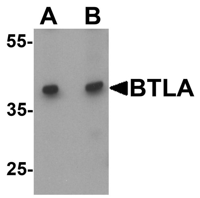 CD272 (BTLA) Antibody in Western Blot (WB)