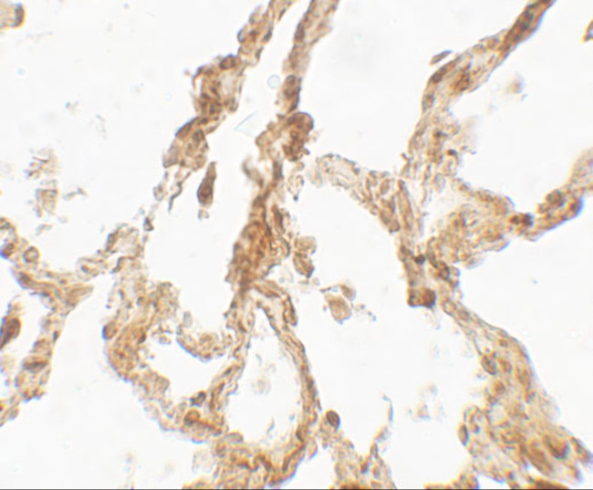 TRPV4 Antibody in Immunohistochemistry (Paraffin) (IHC (P))