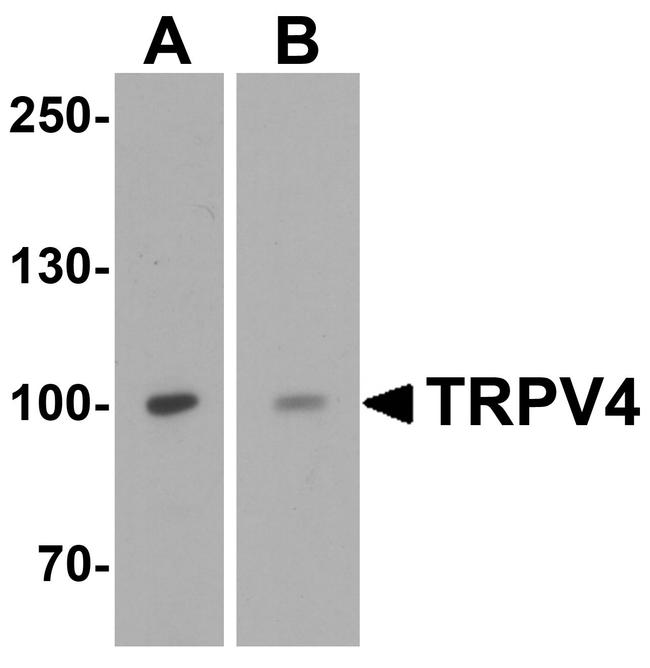 TRPV4 Antibody in Western Blot (WB)