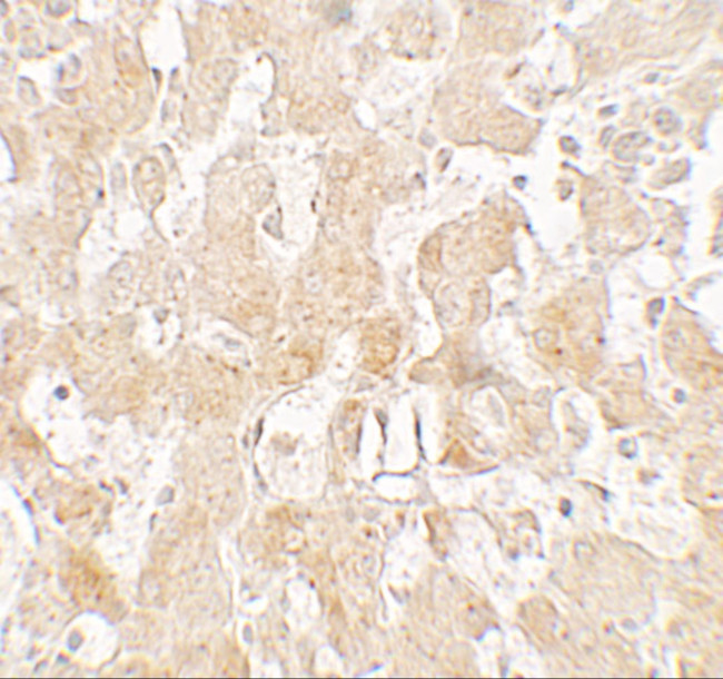 UCP1 Antibody in Immunohistochemistry (Paraffin) (IHC (P))