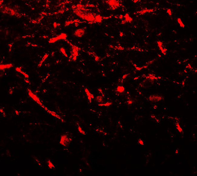 FMRP Antibody in Immunohistochemistry (Paraffin) (IHC (P))