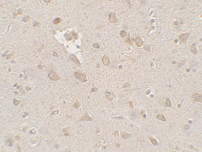 FMRP Antibody in Immunohistochemistry (Paraffin) (IHC (P))