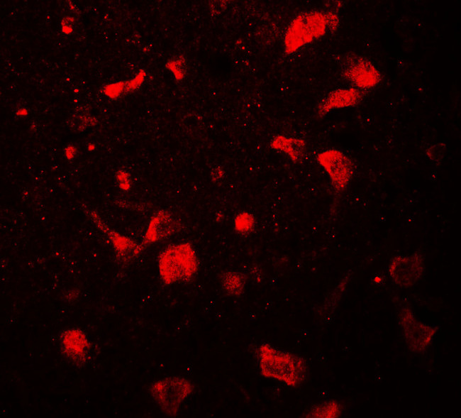 OLIG1 Antibody in Immunohistochemistry (Paraffin) (IHC (P))