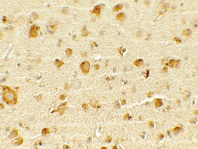 OLIG1 Antibody in Immunohistochemistry (Paraffin) (IHC (P))