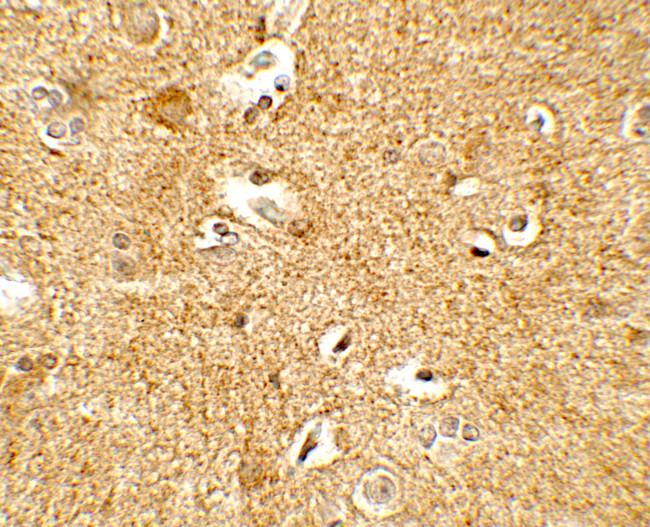 CRF Antibody in Immunohistochemistry (Paraffin) (IHC (P))