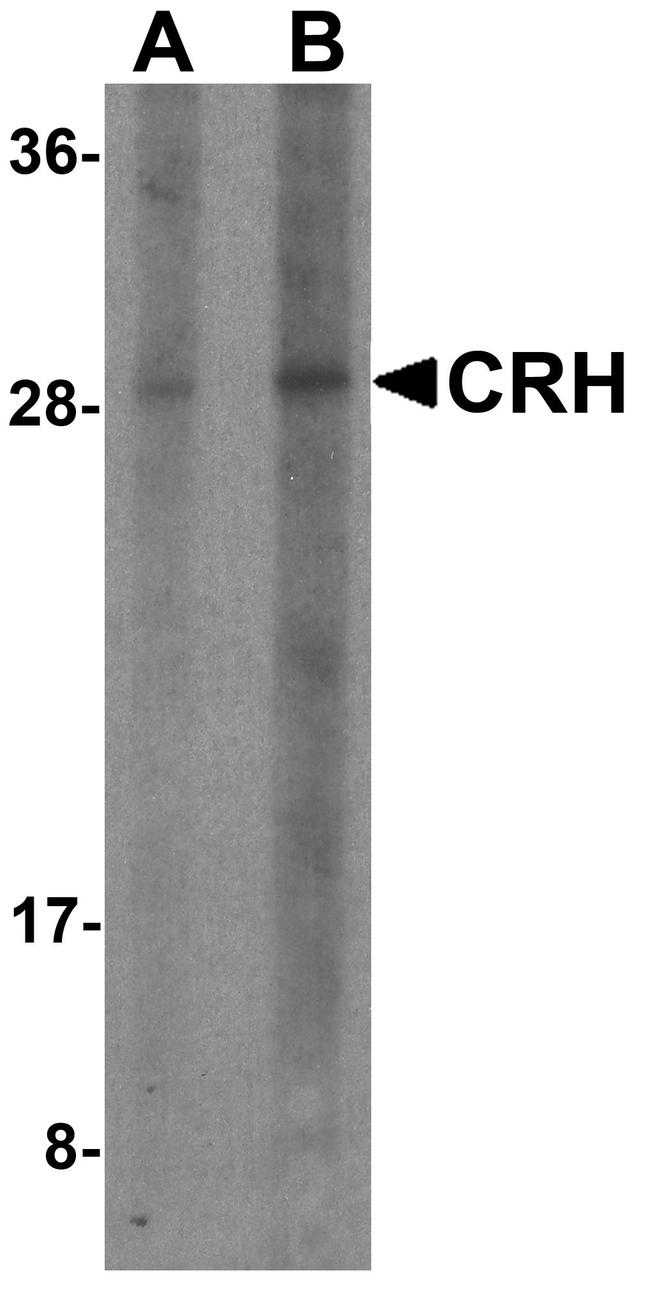 CRF Antibody in Western Blot (WB)