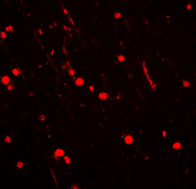 NOX2 Antibody in Immunohistochemistry (Paraffin) (IHC (P))