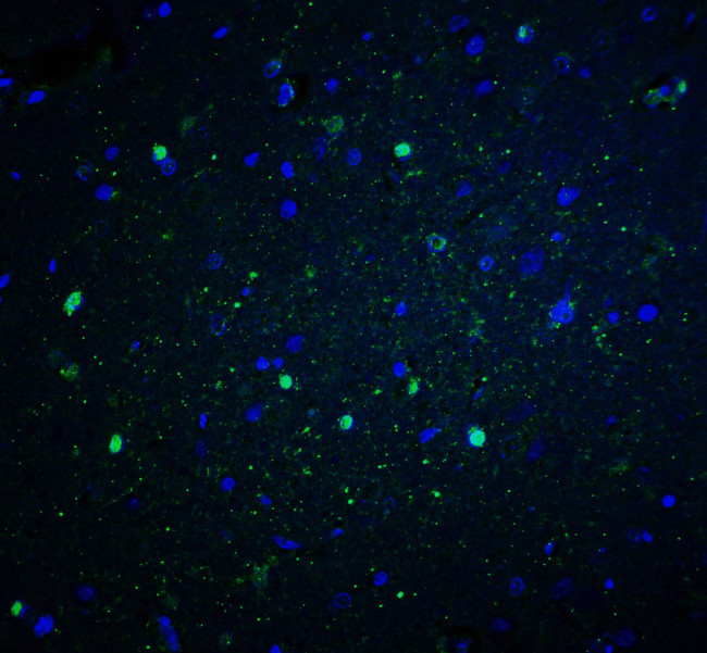 NOX2 Antibody in Immunohistochemistry (Paraffin) (IHC (P))