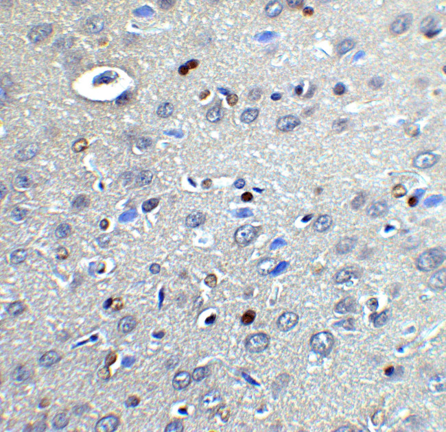 NOX2 Antibody in Immunohistochemistry (Paraffin) (IHC (P))