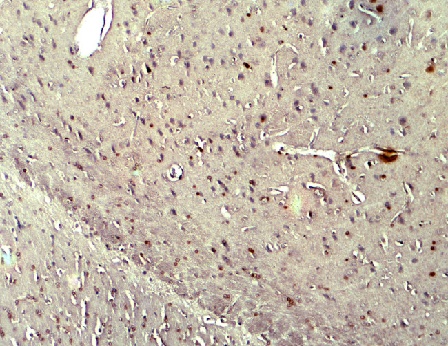 NOX2 Antibody in Immunohistochemistry (Paraffin) (IHC (P))