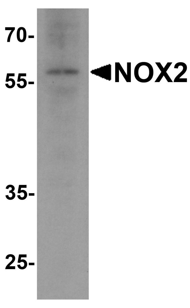 NOX2 Antibody in Western Blot (WB)