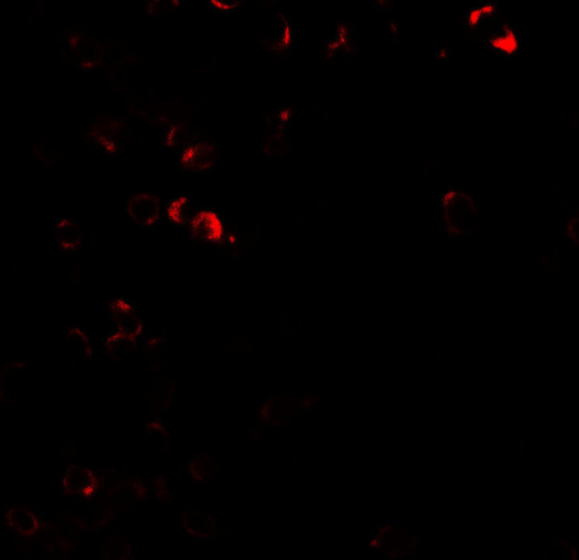 E2F3 Antibody in Immunohistochemistry (Paraffin) (IHC (P))