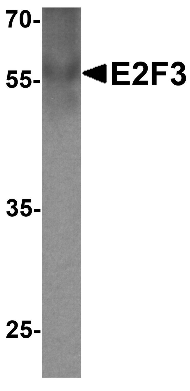 E2F3 Antibody in Western Blot (WB)