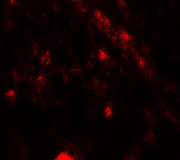 PIK3R4 Antibody in Immunohistochemistry (Paraffin) (IHC (P))