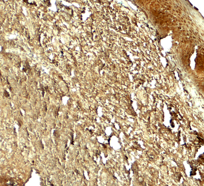 PIK3R4 Antibody in Immunohistochemistry (Paraffin) (IHC (P))