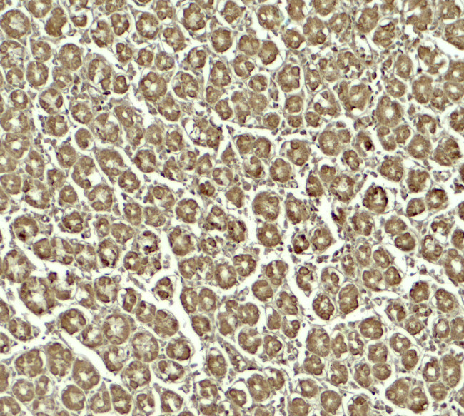 SKIV2L Antibody in Immunohistochemistry (Paraffin) (IHC (P))