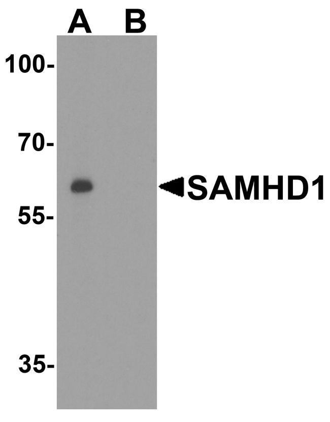 SAMHD1 Antibody in Western Blot (WB)