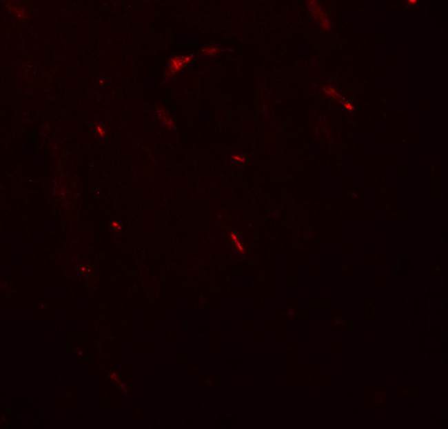 FOXG1 Antibody in Immunohistochemistry (IHC)