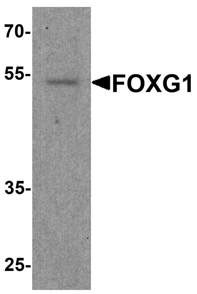 FOXG1 Antibody in Western Blot (WB)