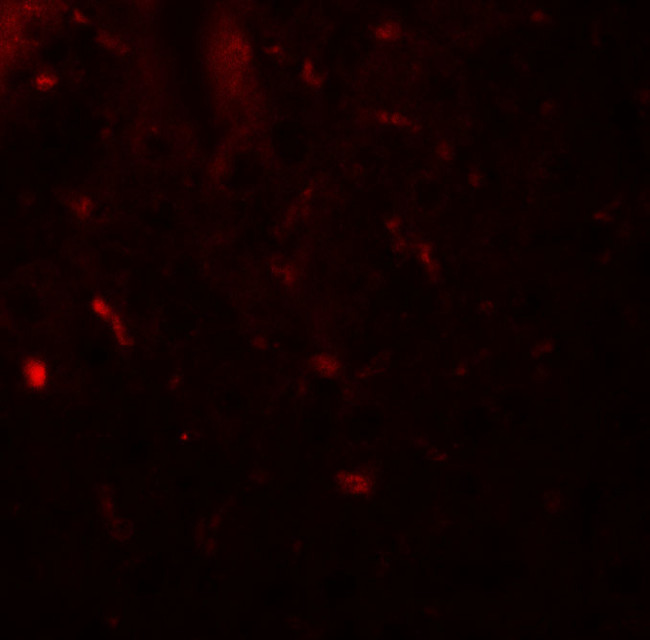 MALT1 Antibody in Immunohistochemistry (Paraffin) (IHC (P))