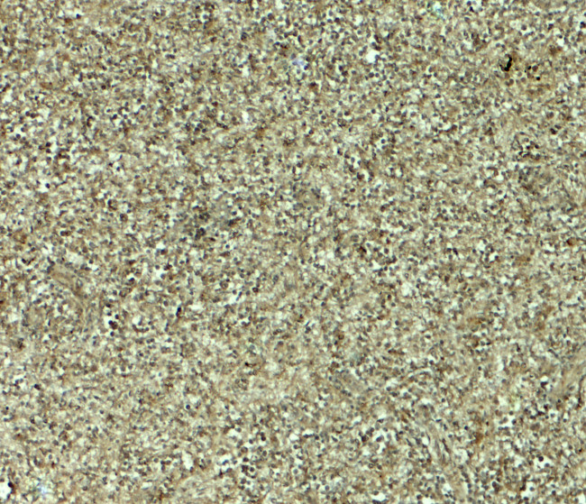 MALT1 Antibody in Immunohistochemistry (Paraffin) (IHC (P))