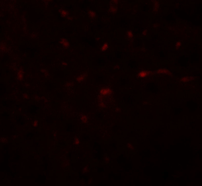 TRIB3 Antibody in Immunohistochemistry (Paraffin) (IHC (P))