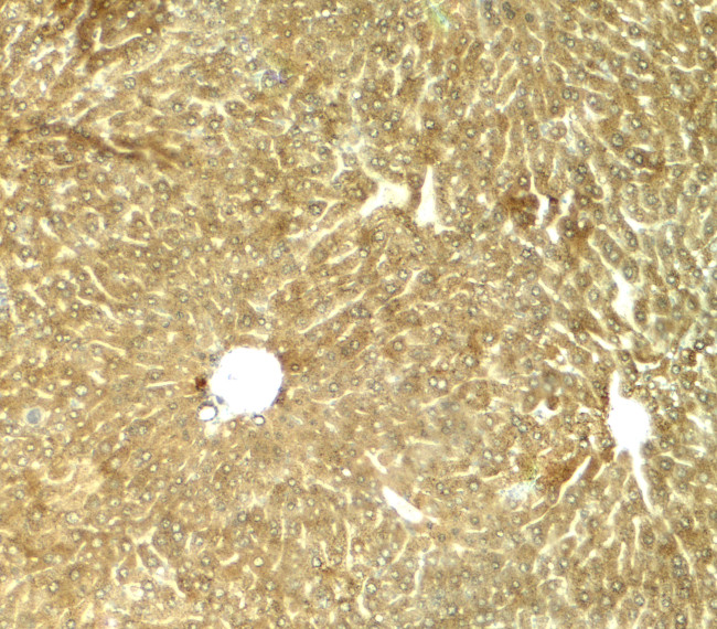 TRIB3 Antibody in Immunohistochemistry (Paraffin) (IHC (P))