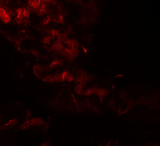 Golgin-97 Antibody in Immunohistochemistry (Paraffin) (IHC (P))