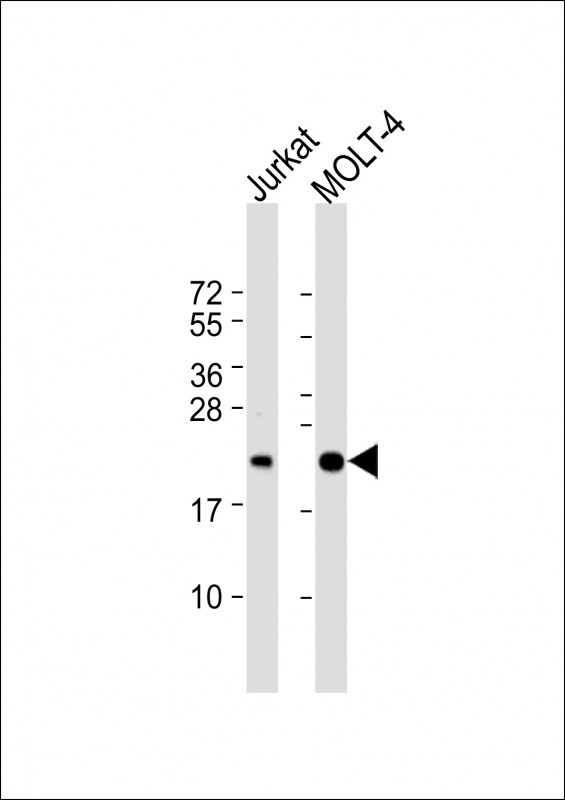 CD3z Antibody in Western Blot (WB)