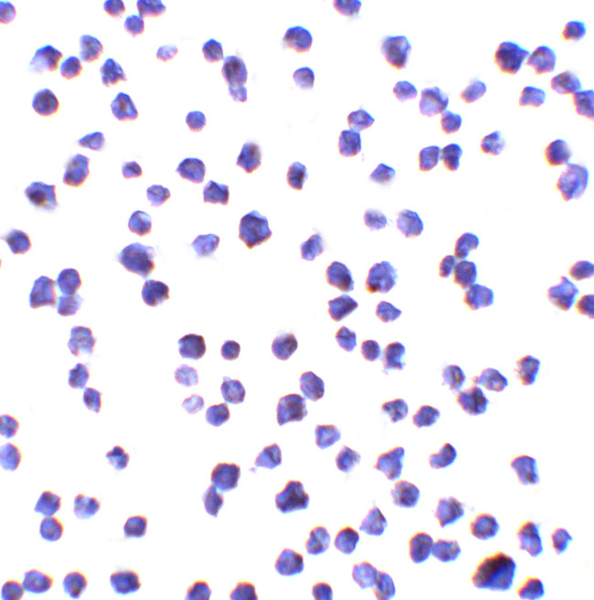 C9orf72 Antibody in Immunocytochemistry (ICC/IF)