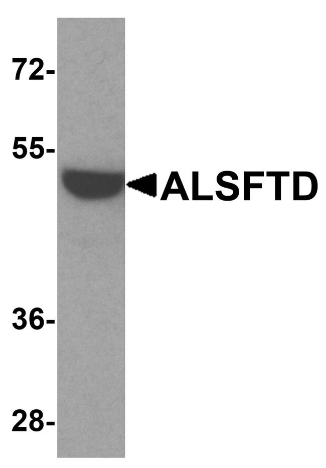 C9orf72 Antibody in Western Blot (WB)